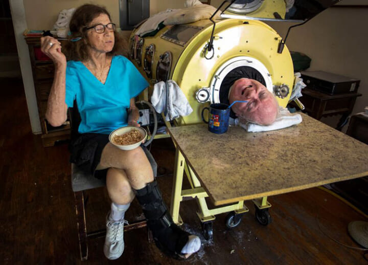 Texas man who lived inside a full-body iron lung from childhood dies at age 78